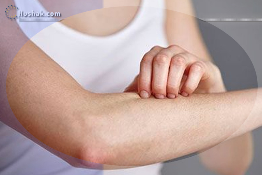 Ժողովրդական բժշկություն. Տան պայմաններում ինչպես ազատվել սնկից